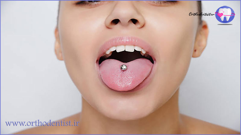 پیرسینگ دهان چیست؟