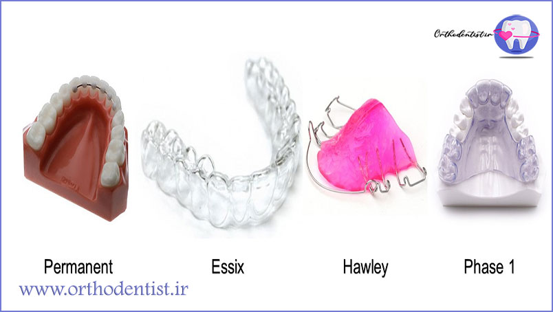  نگهدارنده‌ها (retainers)