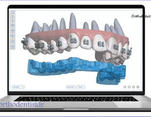 ارتودنسی دیجیتال